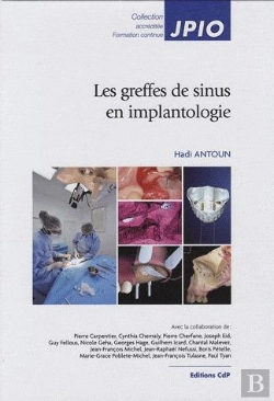 Bertrand.pt - Les Comblements Sinusiens En Implantologie
