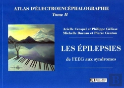 Bertrand.pt - Les Epilepsies De L'Eeg Aux Syndromes. Atlas D'Electroencephalographie Tome Ii
