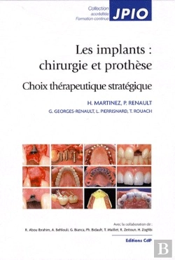 Bertrand.pt - Les Implants : Chirurgie Et Prothèse