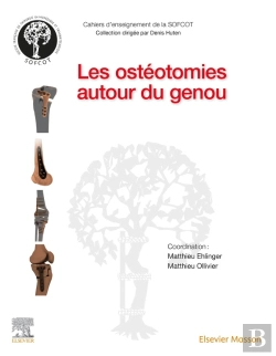 Bertrand.pt - Les Ostéotomies Autour Du Genou