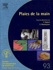 Les Plaies De La Main