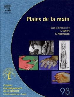 Bertrand.pt - Les Plaies De La Main