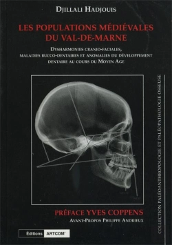 Bertrand.pt - Les Populations Médiévales Du Val-De-Marne : Dyshamroniues Carnio-Facilaes, Maladies Bucco-Dentaires Et Anomalies Du Développement Dentaire Au Co