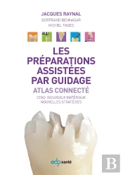 Les Préparations Assistées Par Guidage ; Atlas Connecté