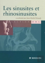 Les Sinusites