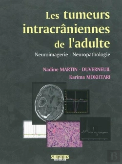Bertrand.pt - Les Tumeurs Intracrâniennes De L'Adulte ; Neuroimagerie, Neuropathologie