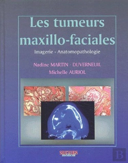 Bertrand.pt - Les Tumeurs Maxillo-Faciales ; Imagerie, Anatomopathologie