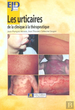 Bertrand.pt - Les Urticaires ; De La Clinique A La Therapeutique