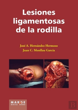 Bertrand.pt - Lesiones Ligamentosas De Rodilla