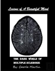Lesions Of A Beautiful Mind