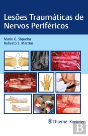 Lesões Traumáticas De Nervos Periféricos