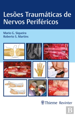 Bertrand.pt - Lesões Traumáticas De Nervos Periféricos