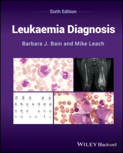 Bertrand.pt - Leukaemia Diagnosis