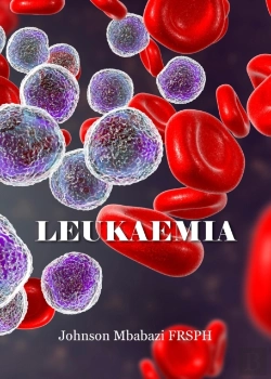 Bertrand.pt - Leukaemia