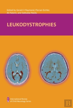 Bertrand.pt - Leukodystrophies