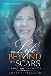 Life Beyond The Scars