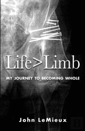 Life Is Greater Than Limb: My Journey To
