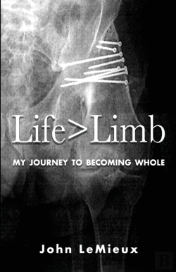Bertrand.pt - Life Is Greater Than Limb: My Journey To