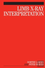 Limb X-Ray Interpretation