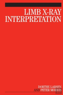 Bertrand.pt - Limb X-Ray Interpretation
