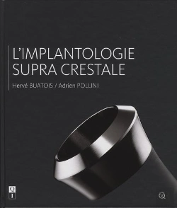 Bertrand.pt - L'Implantologie Supra Crestale
