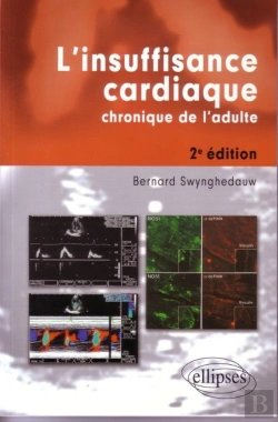 Bertrand.pt - L'Insuffisance Cardiaque Chronique De L'Adulte (2e Édition)