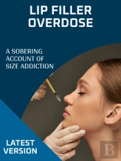 Lip Filler Overdose