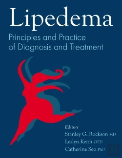 Bertrand.pt - Lipedema