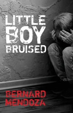 Bertrand.pt - Little Boy Bruised