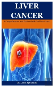 Liver Cancer