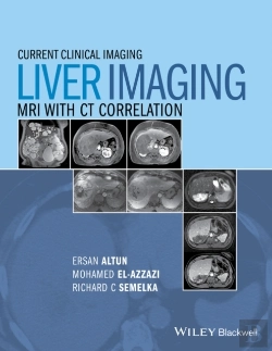 Bertrand.pt - Liver Imaging