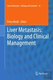 Liver Metastasis: Biology And Clinical Management