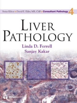 Bertrand.pt - Liver Pathology