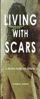 Living With Scars