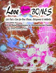 Loves Them Bones  Lets Find A Cure For Bone Disease, Osteoporosis & Arthritis   Challenge 2017