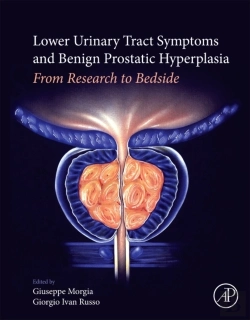 Bertrand.pt - Lower Urinary Tract Symptoms And Benign Prostatic Hyperplasia