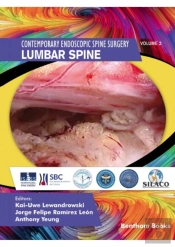 Lumbar Spine