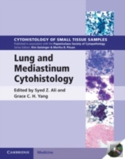 Bertrand.pt - Lung And Mediastinum Cytohistology