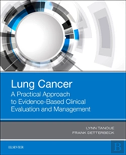 Bertrand.pt - Lung Cancer: A Practical Approach To Evidence-Based Clinical Evaluation And Management