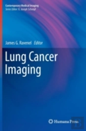 Lung Cancer Imaging