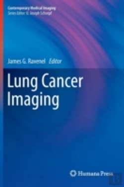 Bertrand.pt - Lung Cancer Imaging