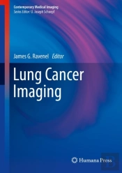 Lung Cancer Imaging