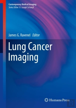 Bertrand.pt - Lung Cancer Imaging