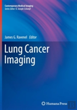 Bertrand.pt - Lung Cancer Imaging