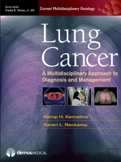 Bertrand.pt - Lung Cancer