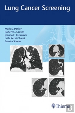 Bertrand.pt - Lung Cancer Screening