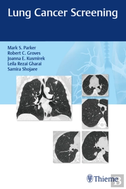 Bertrand.pt - Lung Cancer Screening