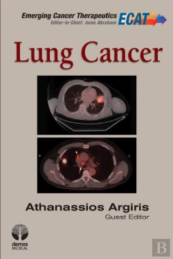 Bertrand.pt - Lung Cancer