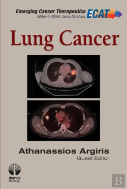 Bertrand.pt - Lung Cancer