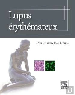 Bertrand.pt - Lupus Érythémateux